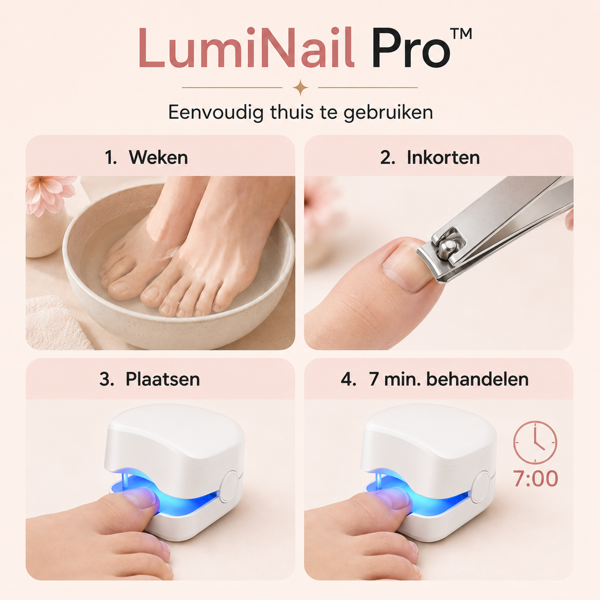 LumiNail Pro™ | Laat uw voeten weer stralen in open schoenen | 1+1 gratis