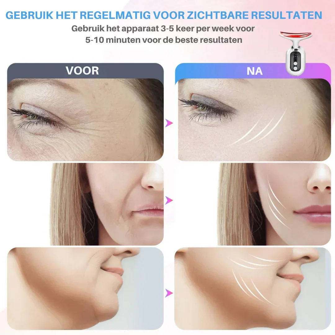 SkinLift Pro - Lumingo