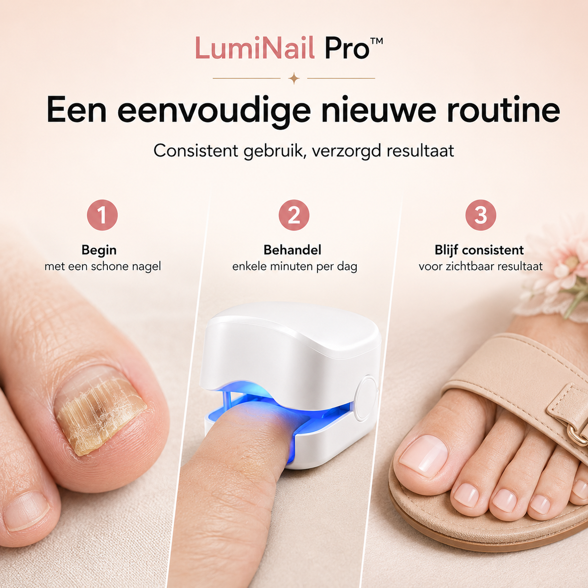 LumiNail Pro™ | Laat uw voeten weer stralen in open schoenen | 1+1 gratis